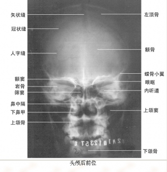 19.jpg 19.jpg