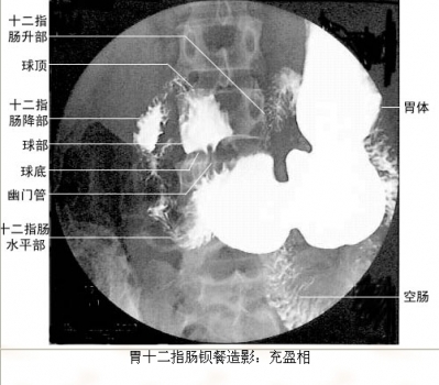23.jpg 23.jpg
