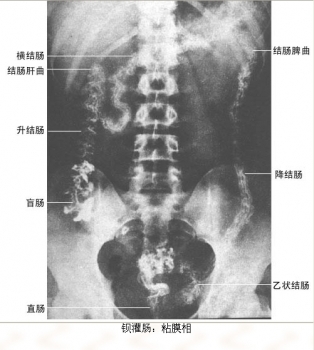 25.jpg 25.jpg