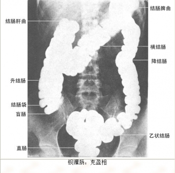 26.jpg 26.jpg