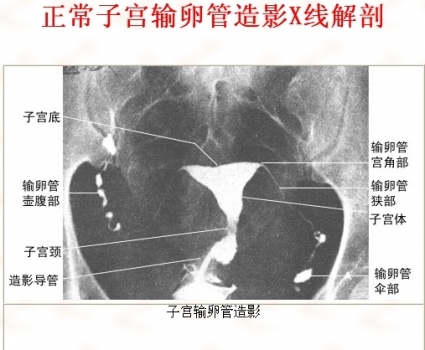 29.jpg 29.jpg